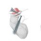 Cirurgia de fimose – benefícios e recuperação Cirurgia de fimose – benefícios e recuperação