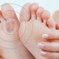 Micose – causas, tratamento e prevenção Micose – causas, tratamento e prevenção