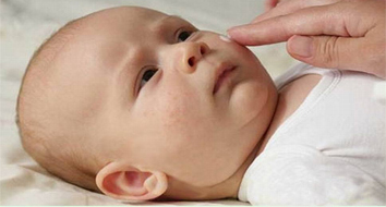 Saúde do bebe: eczema (Dermatite atópica)
